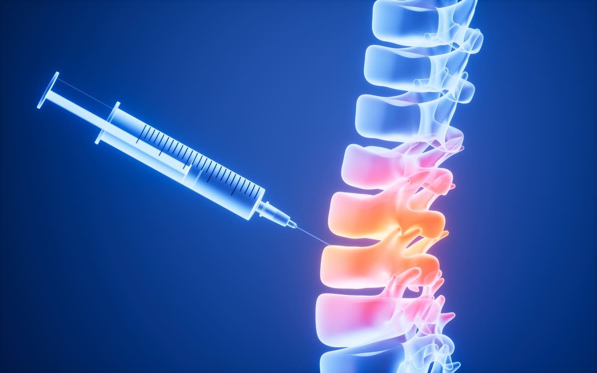 Cervical Facet Joint Injections